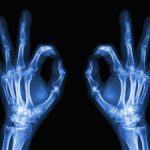 Tạo X-quang từ băng keo dán